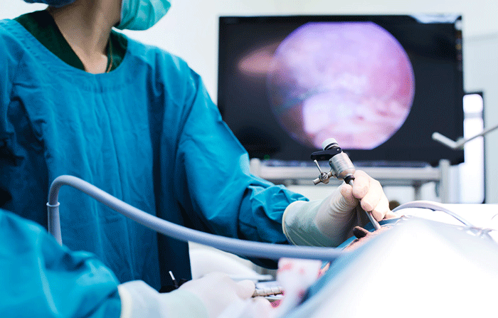 Laparoscopic Surgery